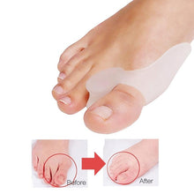 Charger l'image dans la galerie, 1Pair Silicone Toes Separator Bunion Bone Corrector